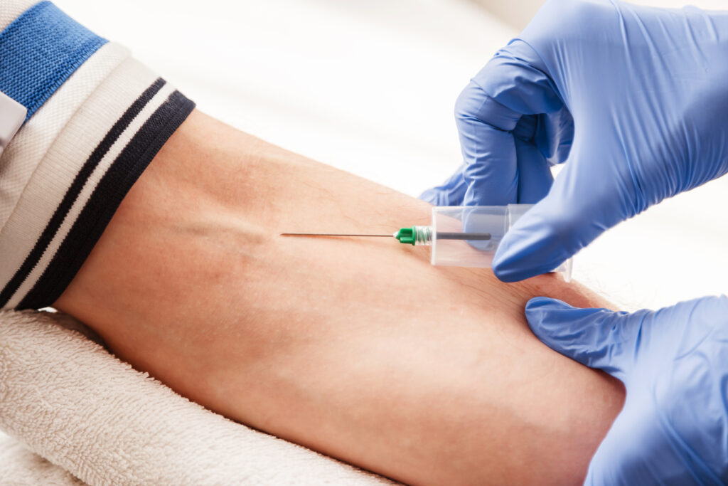 Einem Patient wird am Arm mit einer Nadel Blut abgenommen