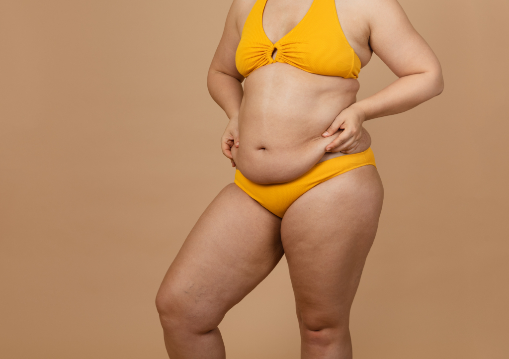 Frau in Bikini greift sich auf ihren Bauch
