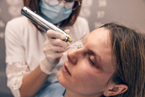 Frau wendet Fibroblasten-Behandlung bei Patientin an