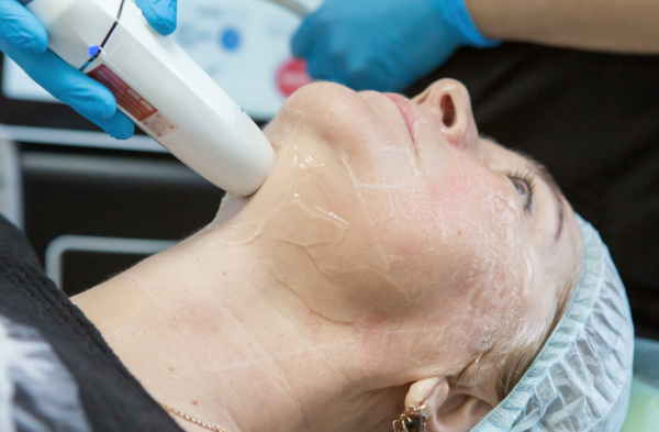 h2 jet peeling wird bei Frau angewandt